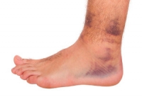 Causes of Ankle Pain